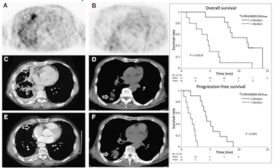 2016 09 02 12 48 50 714 2016 09 05 Hacker Beyer Image3 20160902195415