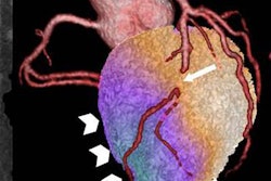 2016 09 07 12 49 00 889 2016 09 Pazhenkottil Hybrid Heart 20160907194942