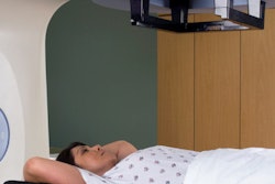 2016 09 08 16 40 09 673 Radiotherapy Breast Cancer 400