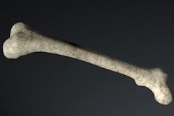 2016 09 13 08 20 12 399 2016 09 13 3 D Bone Thumb