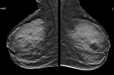 2016 09 22 12 16 21 832 2016 09 23 Eusobi Kuhl Mammop