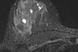 2016 09 23 11 13 07 673 Breast Mri Baltzer2 20160923181518