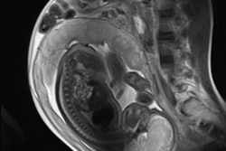 2013 05 31 11 23 19 193 2013 06 03 Fetal Mri
