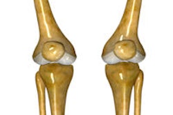 2014 08 01 11 19 55 147 Knee Joint 200