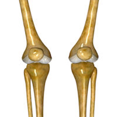 2014 08 01 11 19 55 147 Knee Joint 200