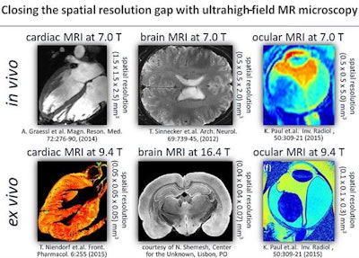 Image courtesy of Dr. Thomas Budinger, PhD; Mark Ladd, PhD; Thoralf Niendorf, PhD; and Dr. Siegfried Trattnig.