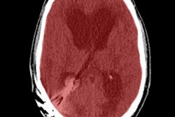 2016 10 07 08 15 22 961 Head Cta Thumb