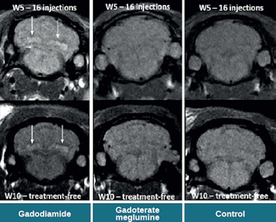 Spontaneous T1 hypersignals in a rat after repeated injections of gadodiamide and gadoterate meglumine. Figure courtesy of Dr. Pierre-Henri Lefevre, republished from le Quotidien des JFR.