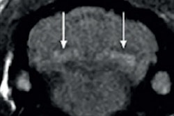 2016 10 17 12 31 53 603 2016 10 18 Jfr Gadolinium Lefevre Thumb