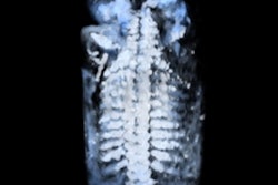 2016 10 18 15 04 32 540 Context6 400