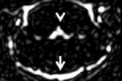 2016 11 21 13 38 40 403 2016 11 22 Mri Rat Thumb