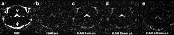 2016 11 22 11 47 55 519 2016 11 22 Mri Rat Fig3a 350