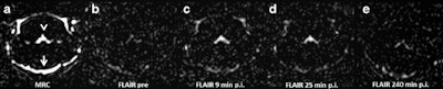 2016 11 22 11 47 57 891 2016 11 22 Mri Rat Fig3a