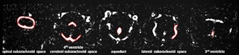 2016 11 22 11 47 58 246 2016 11 22 Mri Rat Fig2 300