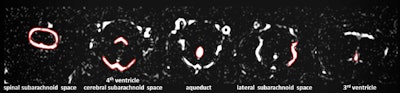 2016 11 22 11 47 58 490 2016 11 22 Mri Rat Fig2a