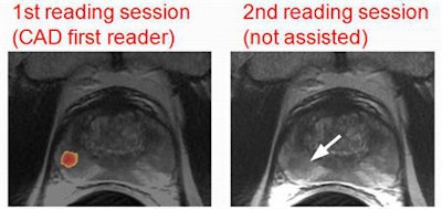 Three expert observers read each image twice, first with the aid of CAD and again six weeks later, unassisted and randomly ordered. Images courtesy of Dr. Valentina Giannini.