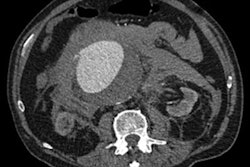 2016 12 13 15 17 46 968 2016 12 14 Ct Abdomen 400 Thumb