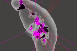 2016 12 14 11 01 05 339 2016 12 Ghodadra Kidney Ruined 400