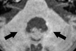 2016 12 14 18 20 13 397 Macro Gbca Radbruch Thumb 400