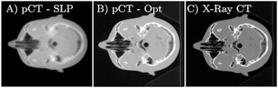 (A) Reconstructed proton CT of a head phantom from the original proton radiography; (B) the reconstruction with the optimized proton radiography; (C) the same slice of the x-ray CT phantom.