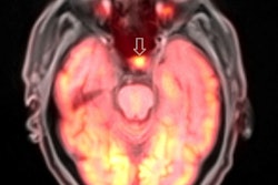 2017 01 04 12 15 52 136 2017 01 05 Pet Mri Thumb