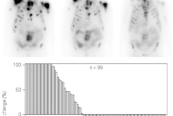 2017 01 05 17 54 16 181 Lu177 Psma Jnm Image 450