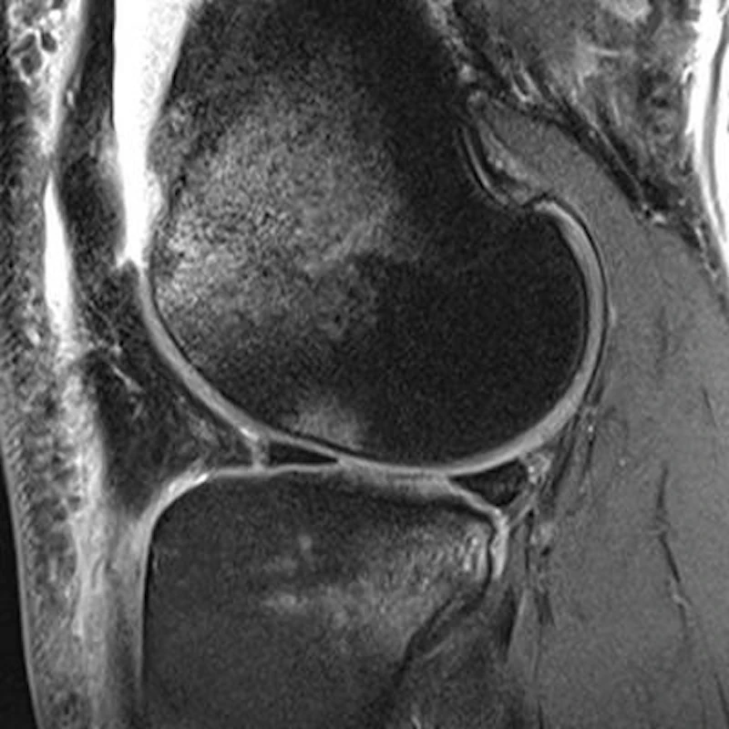 Accelerated Scan Mri Accelerated MRI can bring benefits in daily routine | AuntMinnieEurope