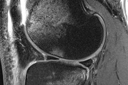 2017 01 09 09 45 02 632 Mri 10 Pix 20170109164542