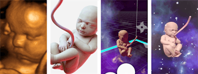Ultrasound scans are converted digitally into a 3D life-like model of a baby. All images courtesy of Samuli Cantell.