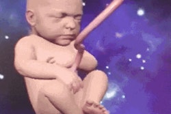 2017 01 18 10 50 00 83 Baby Thumb 20170118175043
