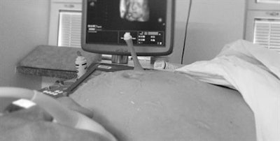 To develop the product, the 4D ultrasound scanning took place at a late stage of pregnancy and lasted around an hour.