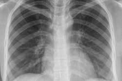 2017 01 20 12 40 52 84 2017 01 23 Refugee Chest Xray Afghani Thumb