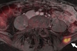 2017 01 27 09 31 11 832 2017 01 26 Pet Mri Grueneisen Thumb