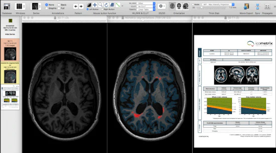 Parszel Parizel calls for more standardization of MRI protocols | AuntMinnieEurope