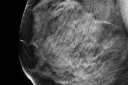 2017 02 06 15 51 10 539 2017 02 07 Dbt 400