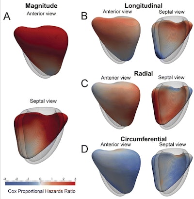 A 3D model of the right ventricle shows the regional contributions to survival prediction in 256 patients with PH. The models show where reduced (red) or increased (blue) systolic motion is associated with death. This is shown by, A, the magnitude of excursion, as well as, B-D, each directional component. The right ventricle is shown in the anterior and septal views, with the left ventricle depicted as a mesh. A reduction in both longitudinal basal motion and transverse bellows contraction is associated with death, as is an increase in circumferential contraction. Images republished with permission of RSNA from Radiology, 16 January 2017.
