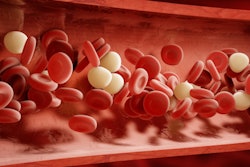 2017 02 08 12 51 49 704 Blood Cell Clot 400