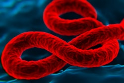 2017 02 08 13 26 24 514 Ebola Virus Red 400