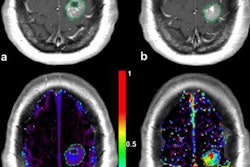 2017 02 24 17 32 04 975 2017 02 27 Mri Insider Pic 20170225003312