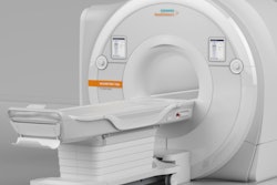 2017 02 27 15 34 17 536 Siemens Vida Mri 400