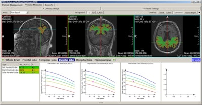 The fully automated segmentation and quantification of different brain regions based on a machine learning algorithm. Software enables the identification of patients at risk of developing dementia long before symptoms of cognitive impairment are apparent. Images courtesy of Dr. Gabriel Krestin, PhD.