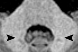 2017 03 14 17 00 39 944 Macro Gbca Mri Radbruch 400