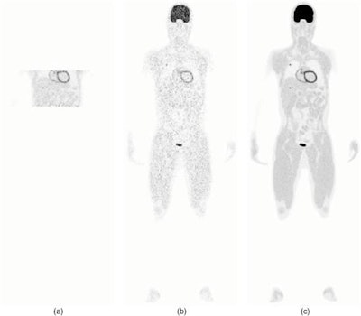 Reconstructed images from three scan protocols. (a) Four block-ring single-bed scan; (b) Four block-ring multi-bed whole-body scan; (c) the EXPLORER total-body scan.