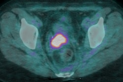 2017 03 23 09 13 42 115 2017 03 23 Pet Ct Thumb