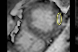 2017 03 28 09 40 58 353 2017 03 Tahir Top 20170328164329