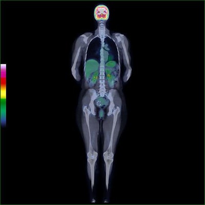 PET/CT continues to offer exciting clinical possibilities, but also poses challenges in training and education. All images courtesy of Dr. Katrine Riklund.