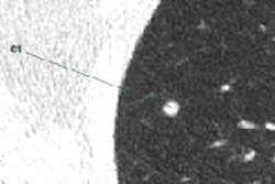 2016 11 04 11 19 46 362 2016 11 07 Cad Nodule Thumb