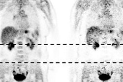 2017 04 05 16 09 06 963 Pet Mri Fdg Dose Jnm Image B 200