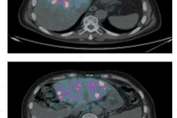 2017 04 11 12 22 04 9 Chiti Figure 2 20170411192243