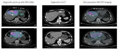 2017 04 11 12 26 16 241 2017 04 12 Chiti Fig2 800